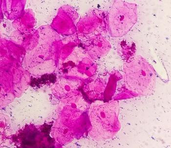 Dequalinium chloride found noninferior to metronidazole for BV treatment | Image Credit: © Arif Biswas - © Arif Biswas - stock.adobe.com.