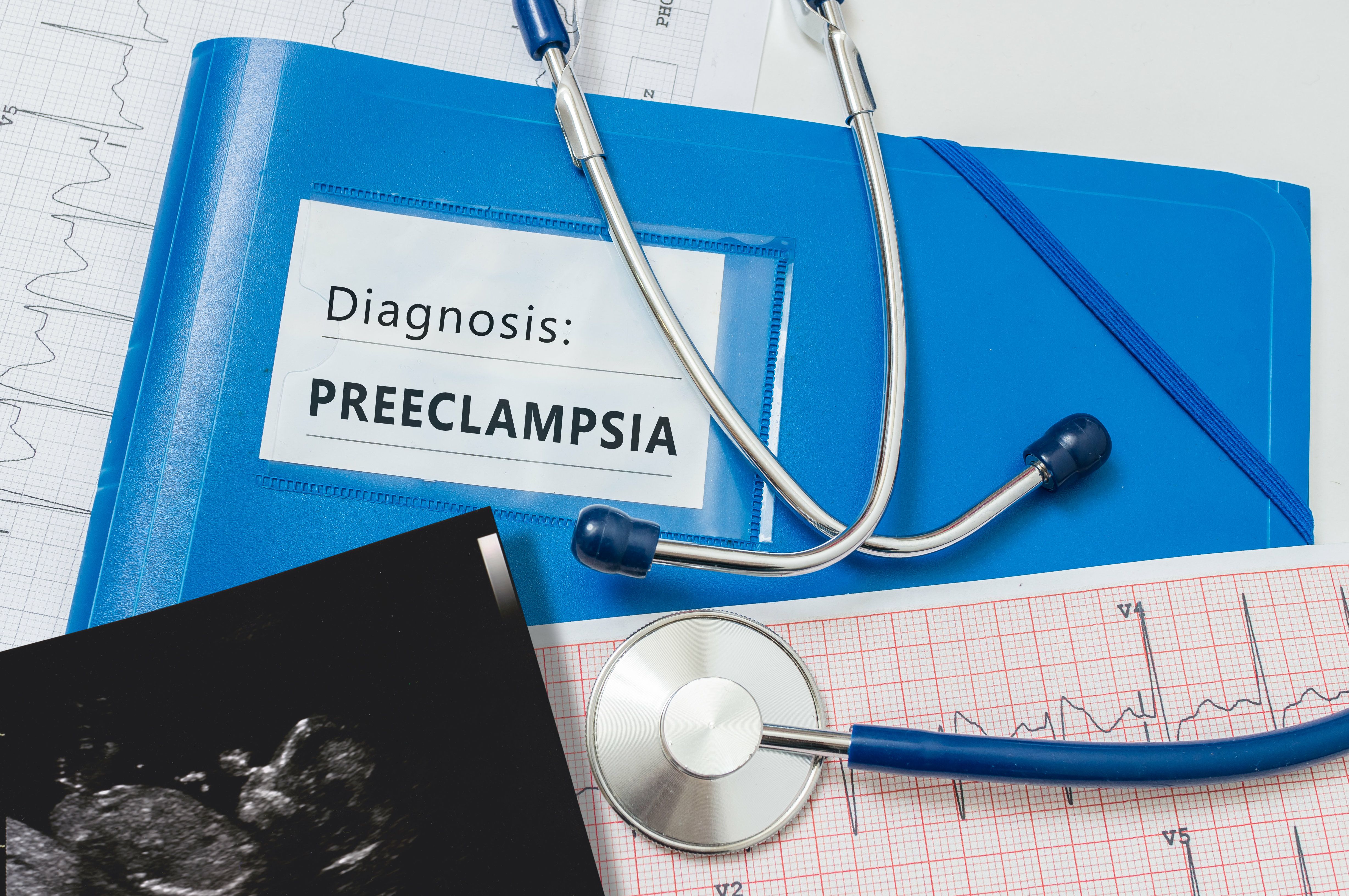 How sFlt-1/PlGF ratio predicts preeclampsia risk | Image Credit: © vchalup - © vchalup - stock.adobe.com.
