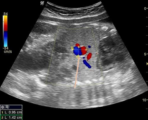 Image IQ: Third Trimester Fetus