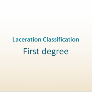 The four classifications of perineal lacerations