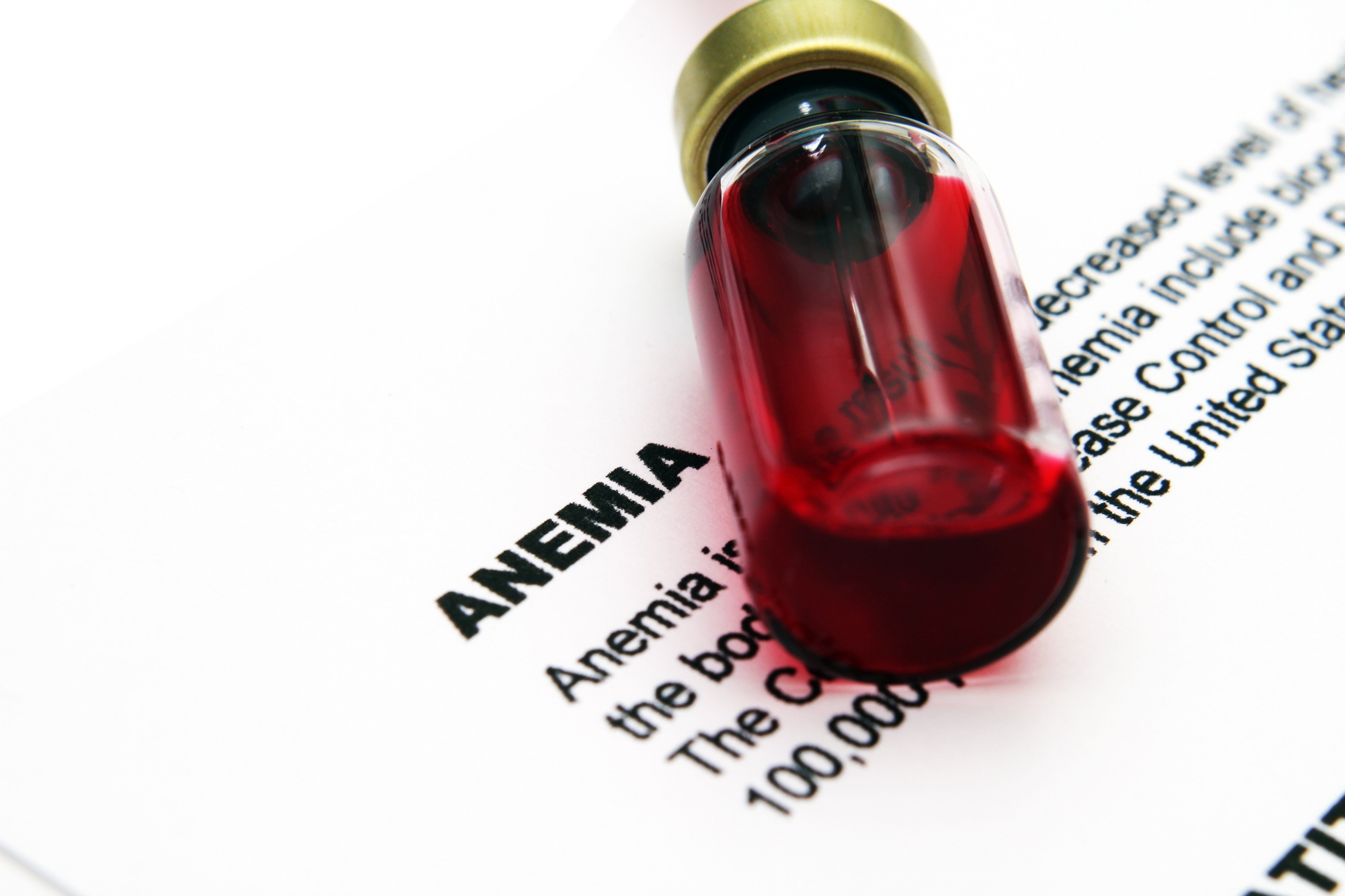 Anemia
