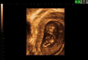 3D Surface Rendering Embryo