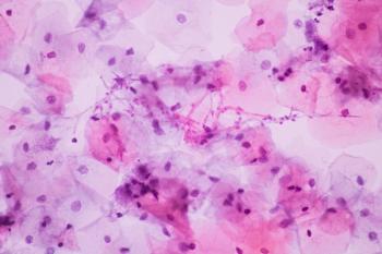 Discussing the link between bacterial vaginosis and vulvovaginal candidiasis | Image Credit: © arcyto - © arcyto - stock.adobe.com.