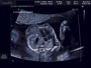 Ultrasounds images: Fetal anomalies of the first and second trimesters (Part 2)