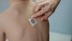 Phase 3 trial meets primary endpoint for VIASKIN Peanut patch in children aged 4–7 years | Image Credit: DBV Technologies