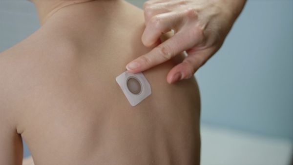 Phase 3 trial meets primary endpoint for VIASKIN Peanut patch in children aged 4–7 years | Image Credit: DBV Technologies