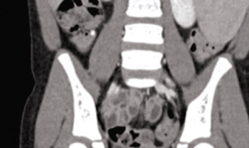 image of CT scan