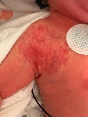 Just a little birthmark? 