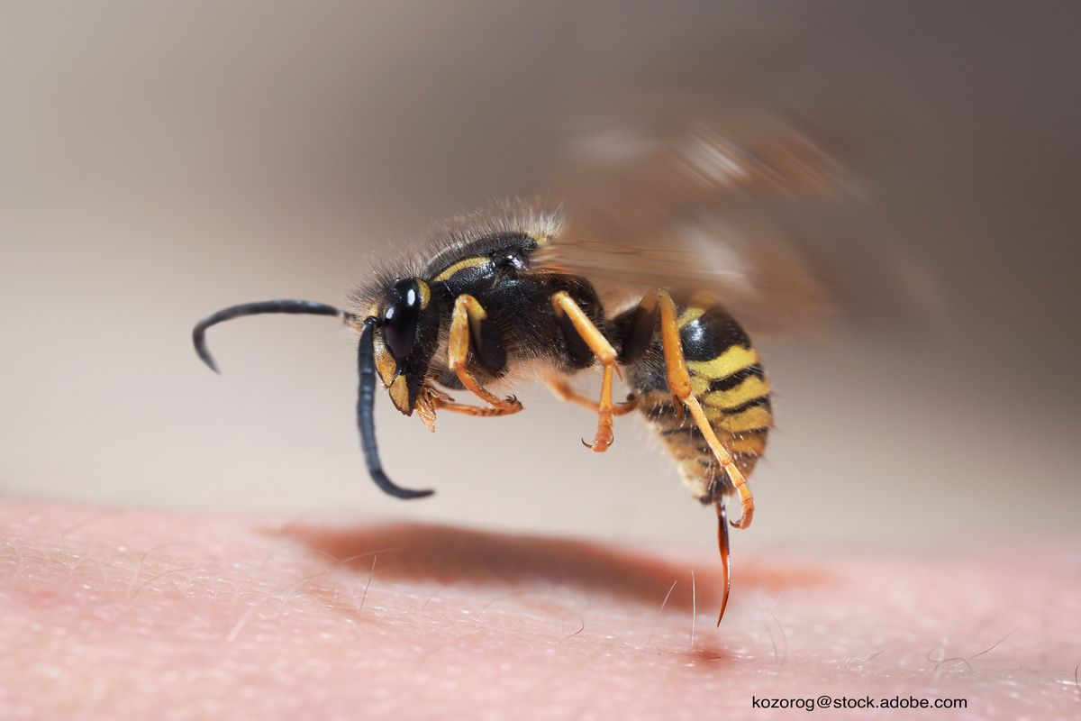 Shoulder pain following a sting in a 2yearold