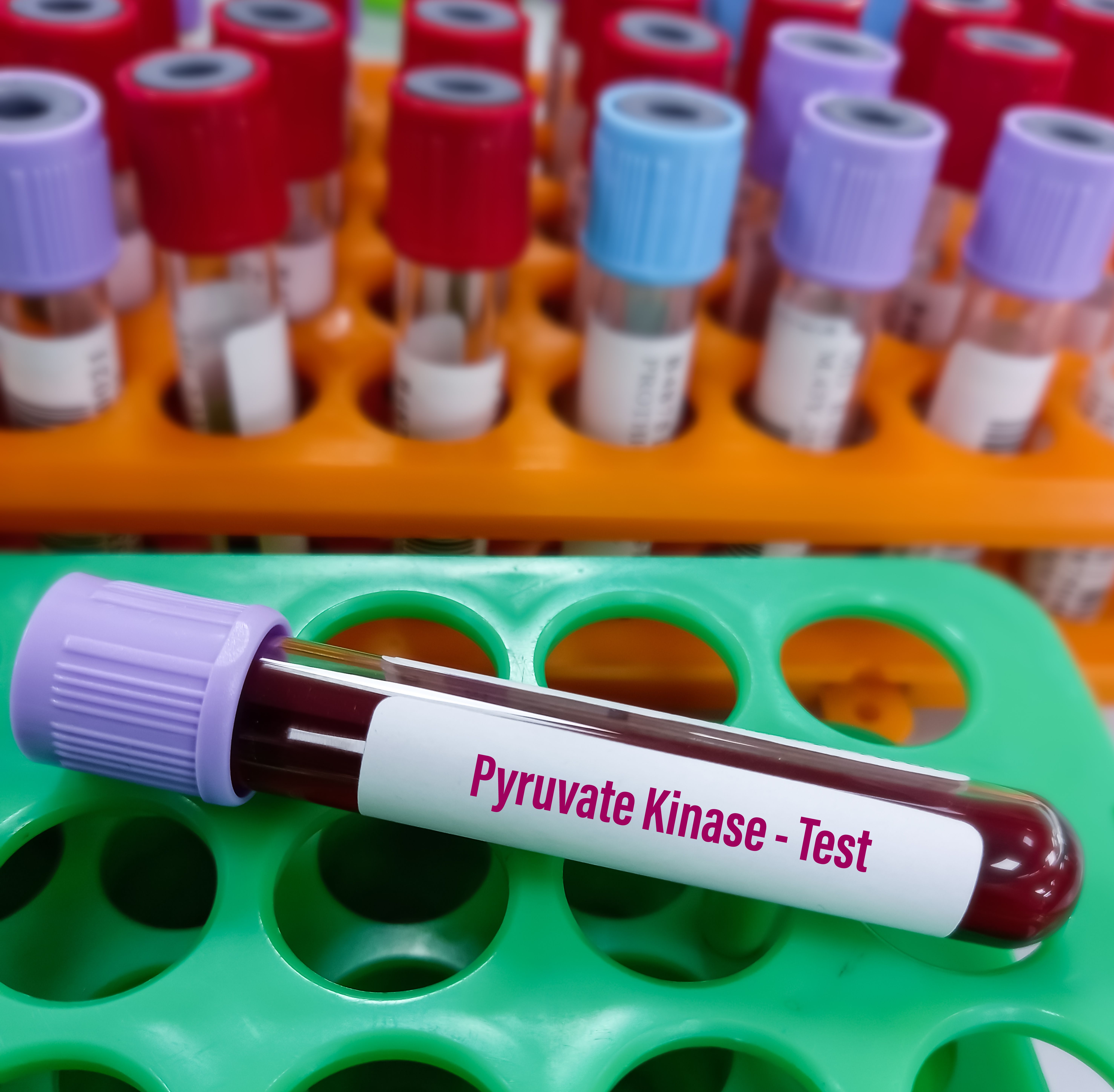 Mitapivat phase 3 data clinically meaningful for children 1 to <17 years with pyruvate kinase | Image Credit: © MdBabul - © MdBabul - stock.adobe.com.