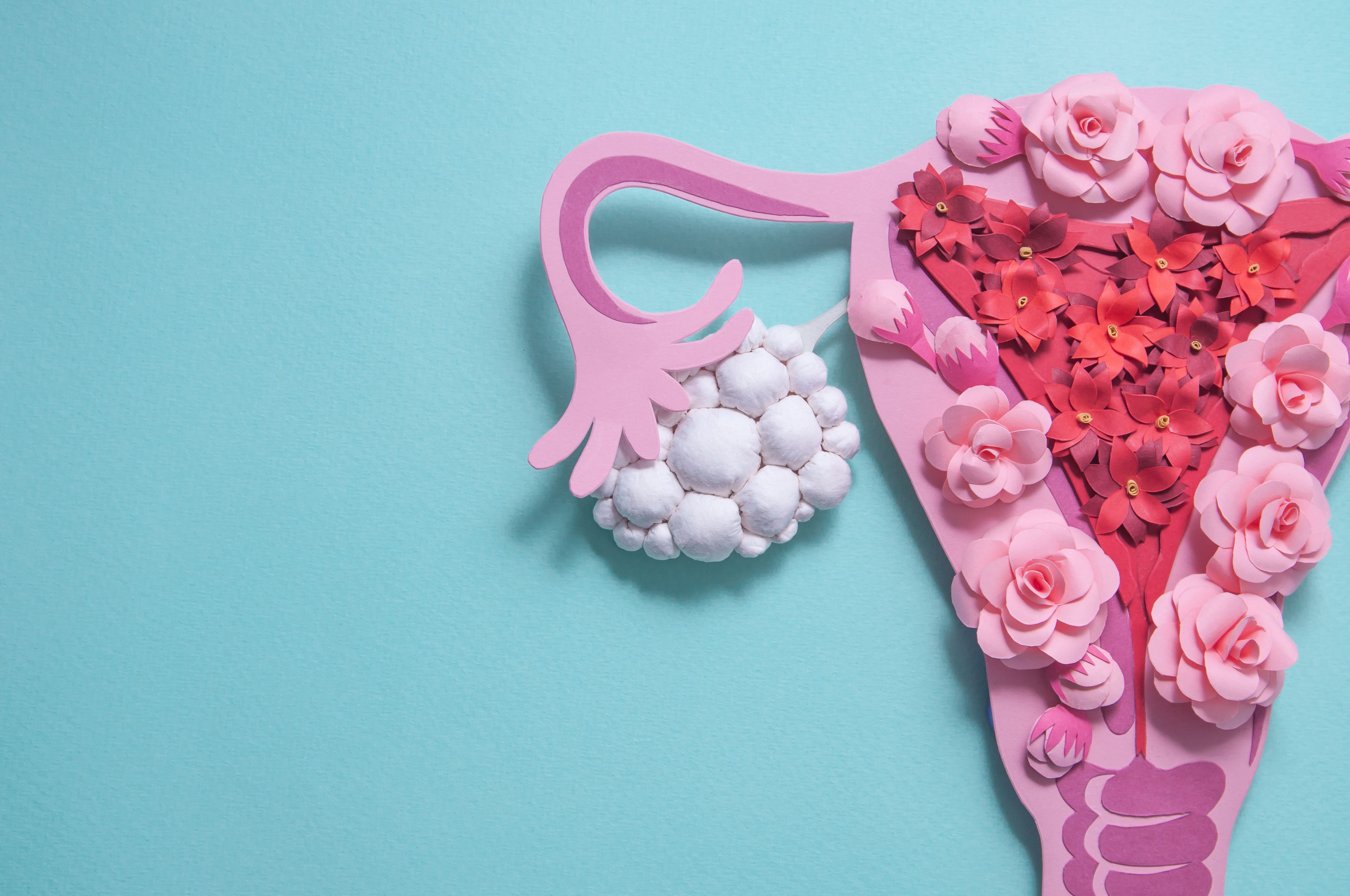 PMOS adopted as new name for PCOS after global consensus process | Image Credit: © Alena - stock.adobe.com.