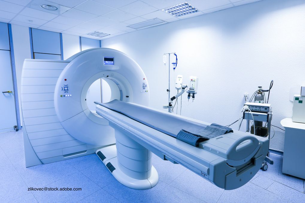 CT imaging often has negative findings for COVID19