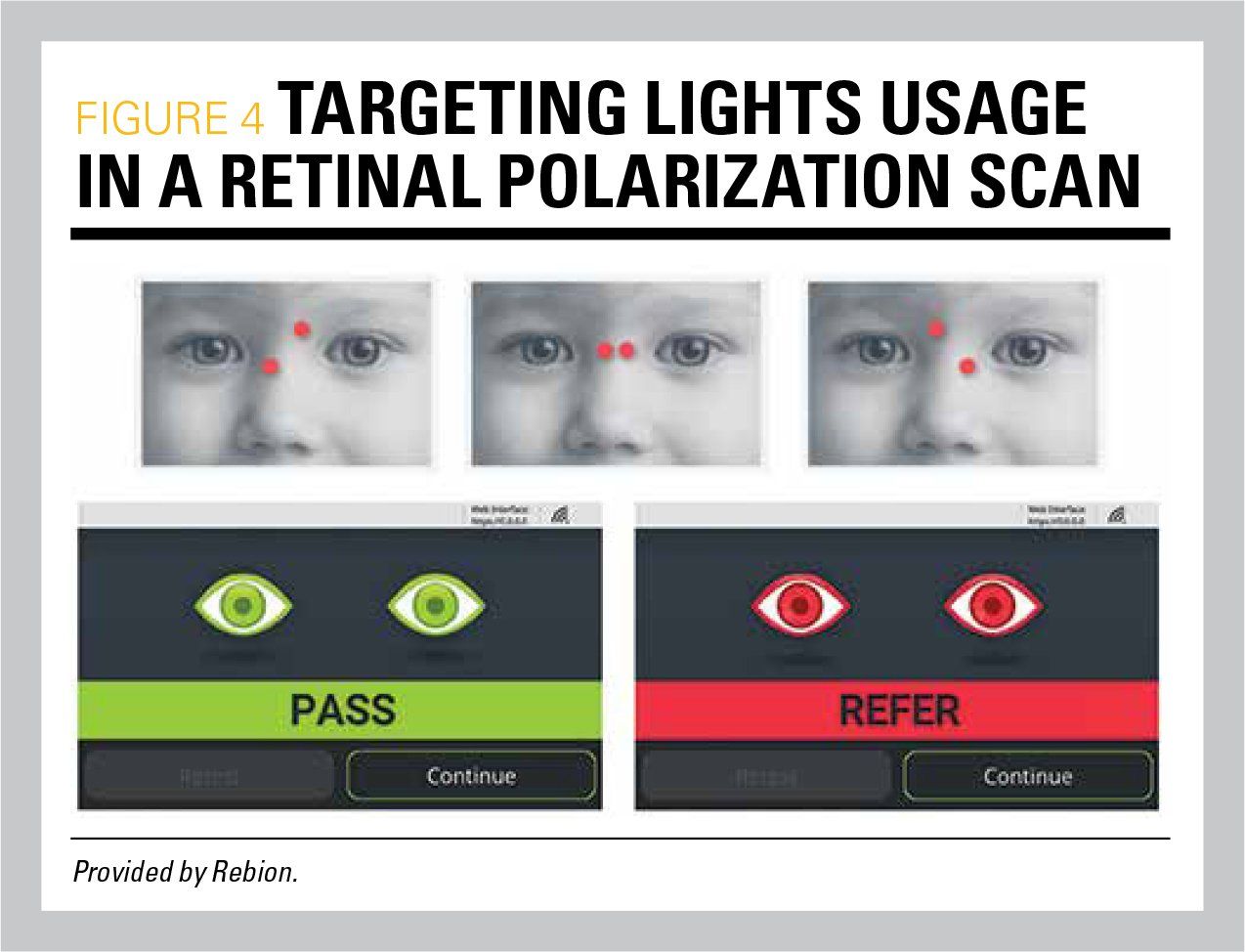 Targeting lights usage in a retinal polarization scan