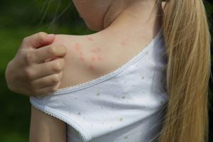 Adverse childhood experiences may influence pediatric skin disease trajectories | Image Credit: © triocean - stock.adobe.com.