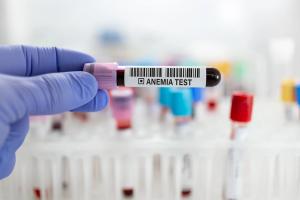 Updated AAP guidance changes iron deficiency screening and treatment in children | Image Credit: © angellodeco - stock.adobe.com.