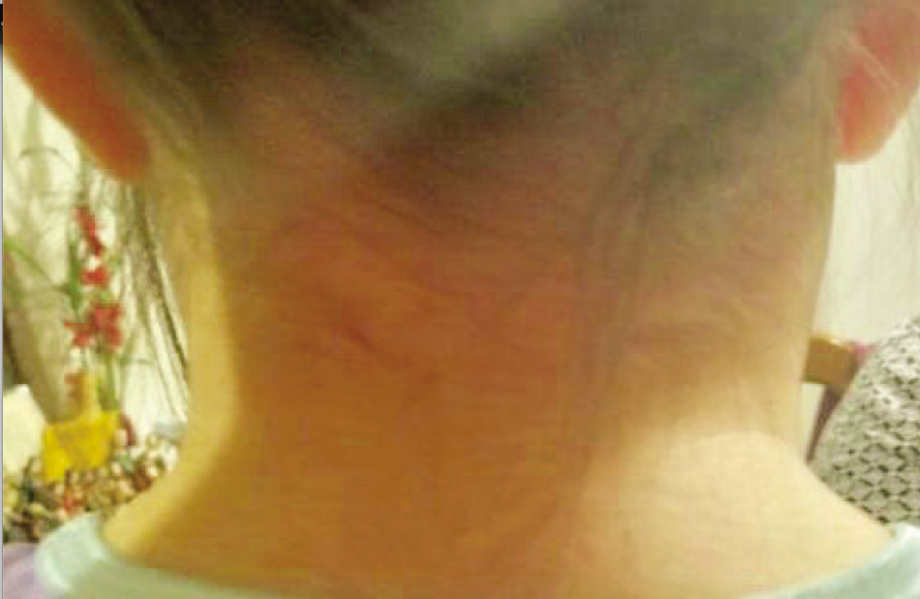 8 Year Old Girl With Pain In Her Neck 8 Year Old Girl With Pain In Her Neck