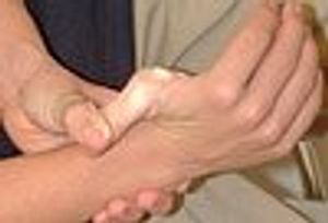 Unusual Skin Elasticity, Joint Hypermobility, Violaceous Plaques in 3 Different Patients: What’s Your Diagnosis?