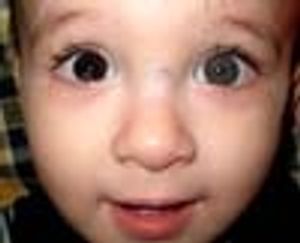 Young Boy With Different Colored Eyes