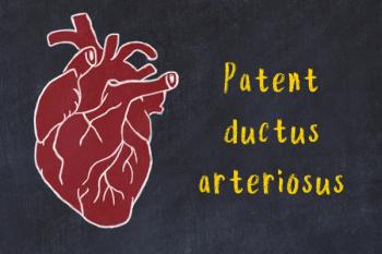 Transcatheter and surgical PDA yield comparable respiratory results in very preterm infants | Image Credit: © iushakovsky - © iushakovsky - stock.adobe.com.