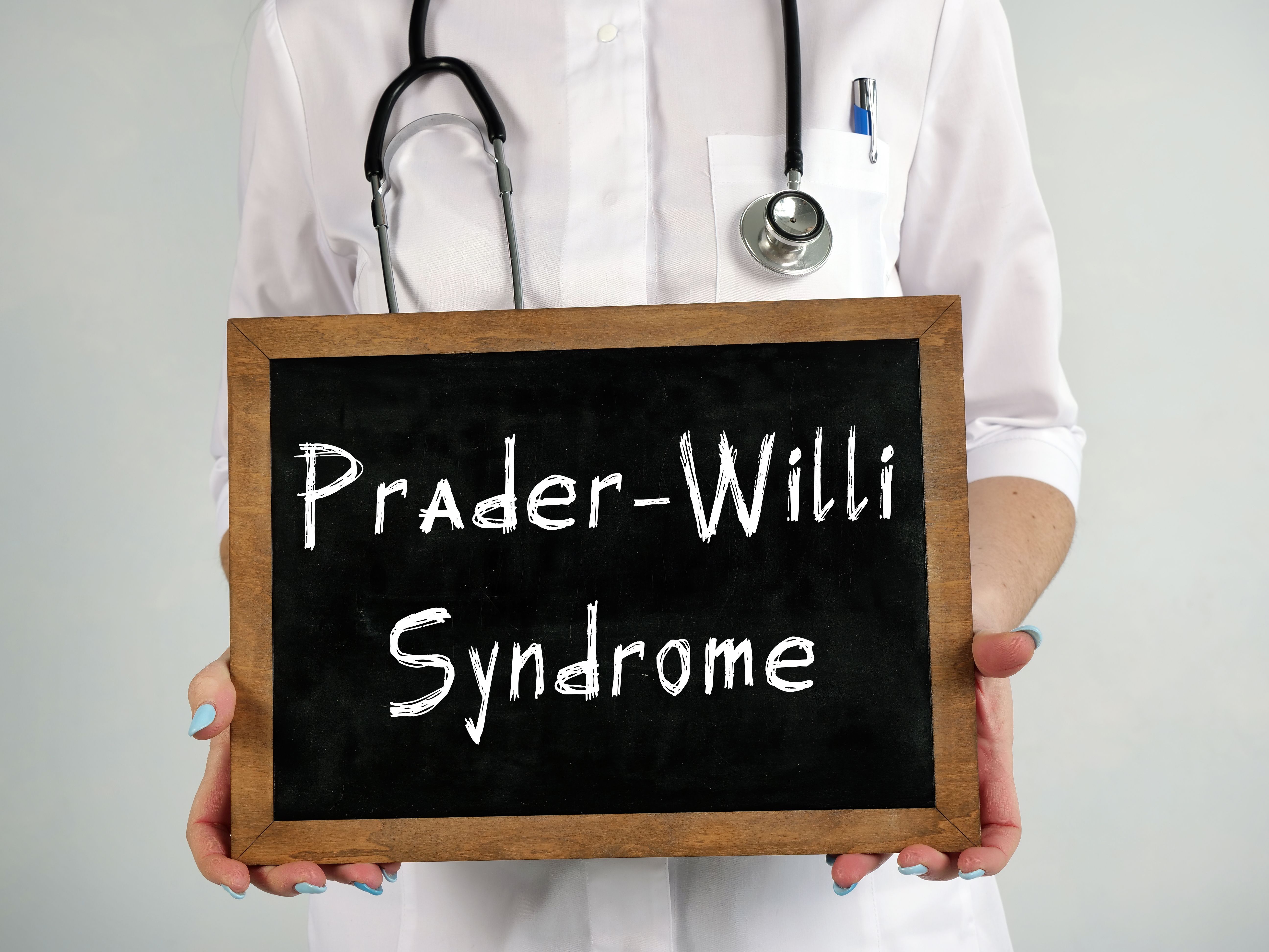 Diazoxide choline data show durable hyperphagia gains in Prader-Willi syndrome | Image Credit: © Yurii Kibalnik - stock.adobe.com.