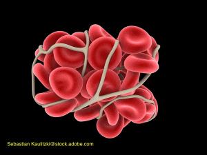 New Phase 3 data advances pursuit of pediatric indication for Xarelto