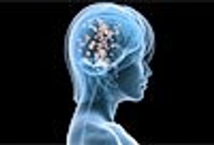 Teenager with Persistent Headache, Irritable Mood, and Weight Gain