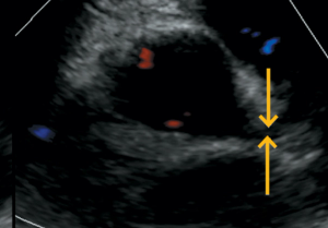 Fever, conjunctivitis, rash, and belly pain