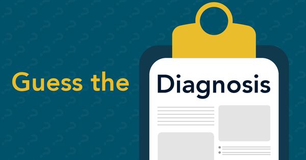 Can you guess the diagnosis of this 19-year-old boy with Down syndrome and progressive loss of communication?