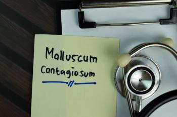 FDA-approved berdazimer gel, 10.3% launches to treat molluscum contagiosum | Image Credit: © syahrir - ©syahrir - stock.adobe.com.