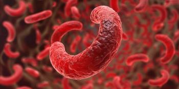 Sickle Cell Disease: Promises for a brighter future | Image Credit: © Oleksandr - © Oleksandr - stock.adobe.com.