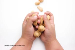 image illustrating common and serious food allergen