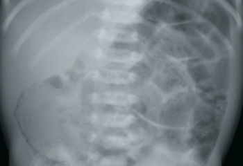 close-up of figure 1