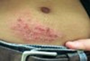 Skin Disorders: 5 Shots, 5 Tips