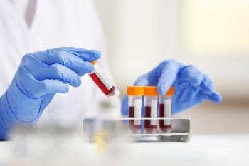 Lanadelumab shown to significantly reduce hereditary angioedema attacks in Japanese patients | Image Credit: © Africa Studio - ©Africa Studio - stock.adobe.com.