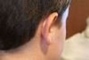 Home Remedies for Ear Pain on the Ground and in the Air