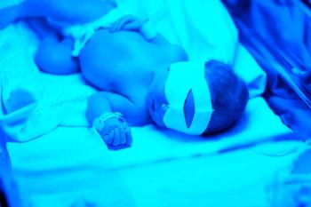 Clinical guideline reduces time to phototherapy in neonatal jaundice | Image Credit: © haveseen - stock.adobe.com.