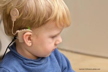 cochlear implant on child