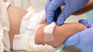Nonreceipt of newborn intramuscular vitamin K linked to doubled bleeding risk | Image Credit: © Pixel_Studio_8 - Adobe Stock