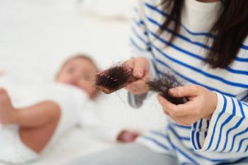Disease severity, phenotype predict systemic treatment response in pediatric alopecia areata  | Image Credit: © geargodz - stock.adobe.com.