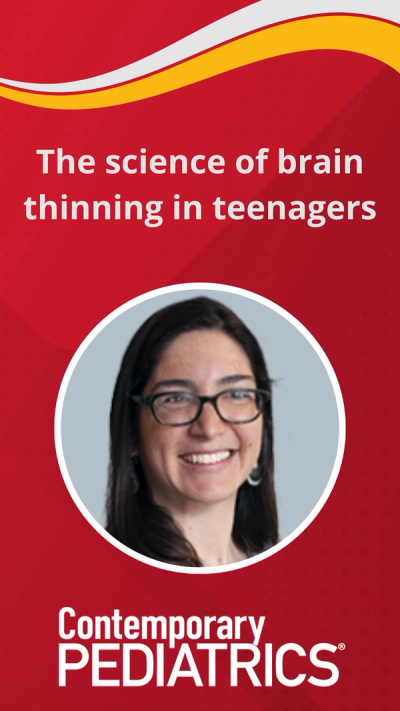 The science of brain thinning in teenagers