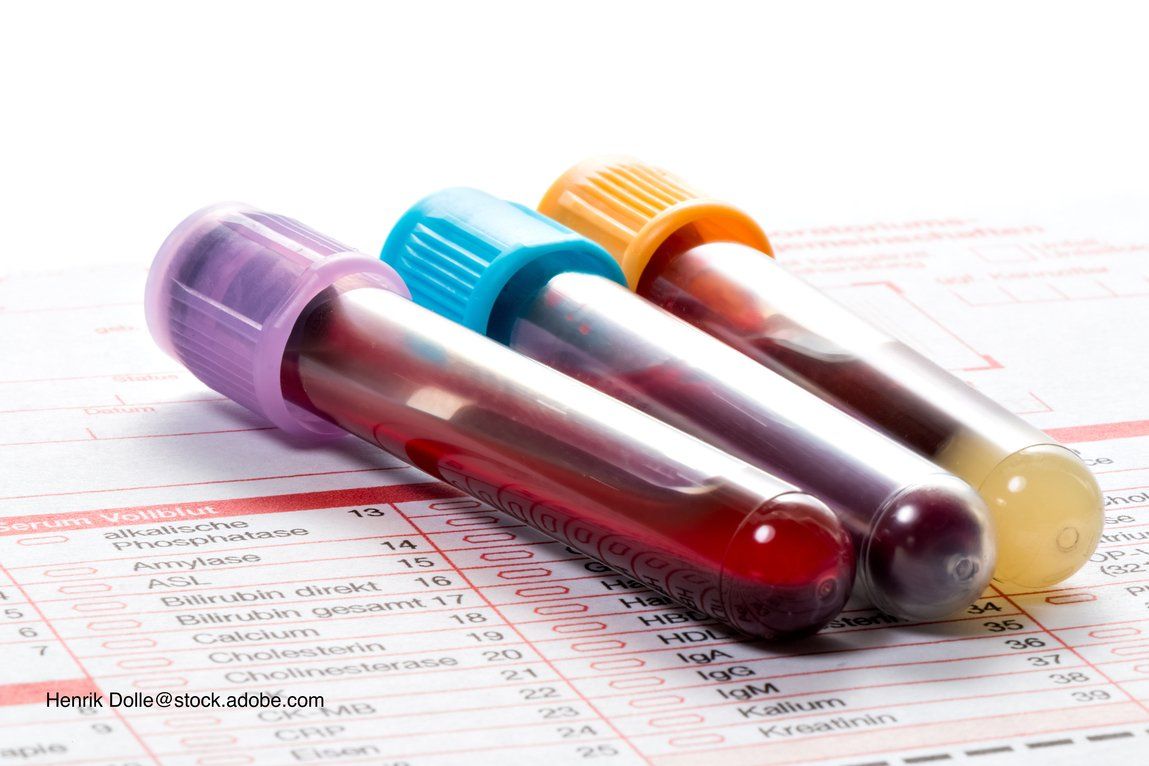 What to consider before running a diagnostic test