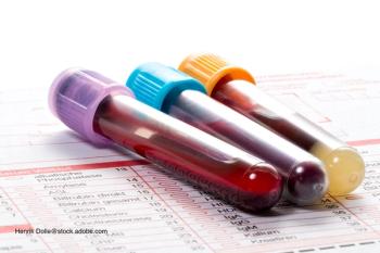 infectious disease tests