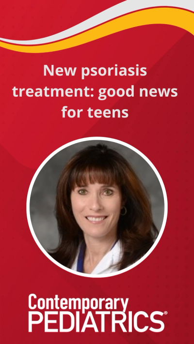 New psoriasis treatment: good news for teens | Image Credit: henryford.com.
