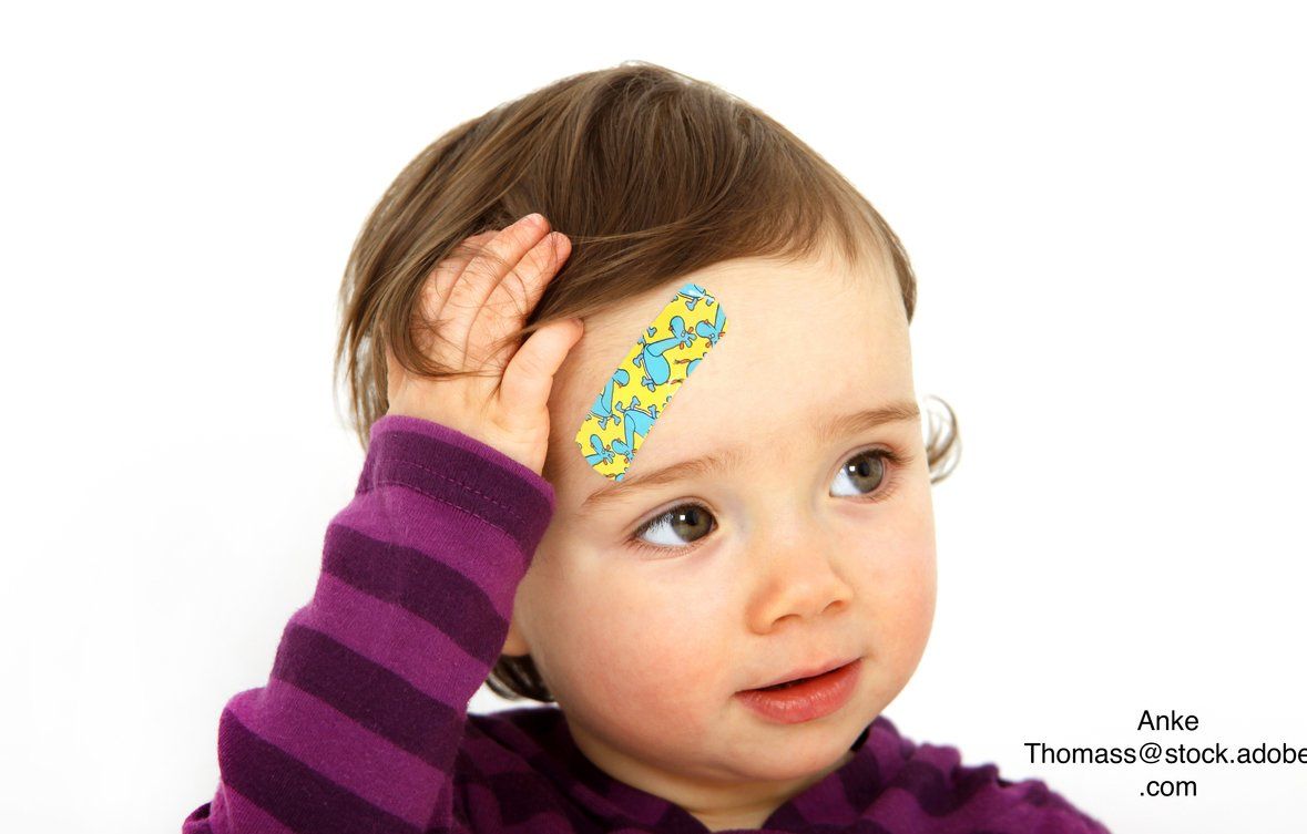image of little girl with a head injury