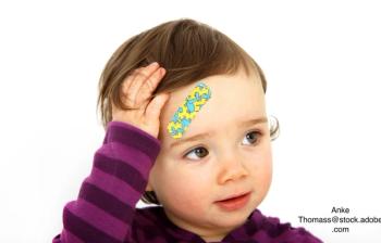 image of little girl with a head injury