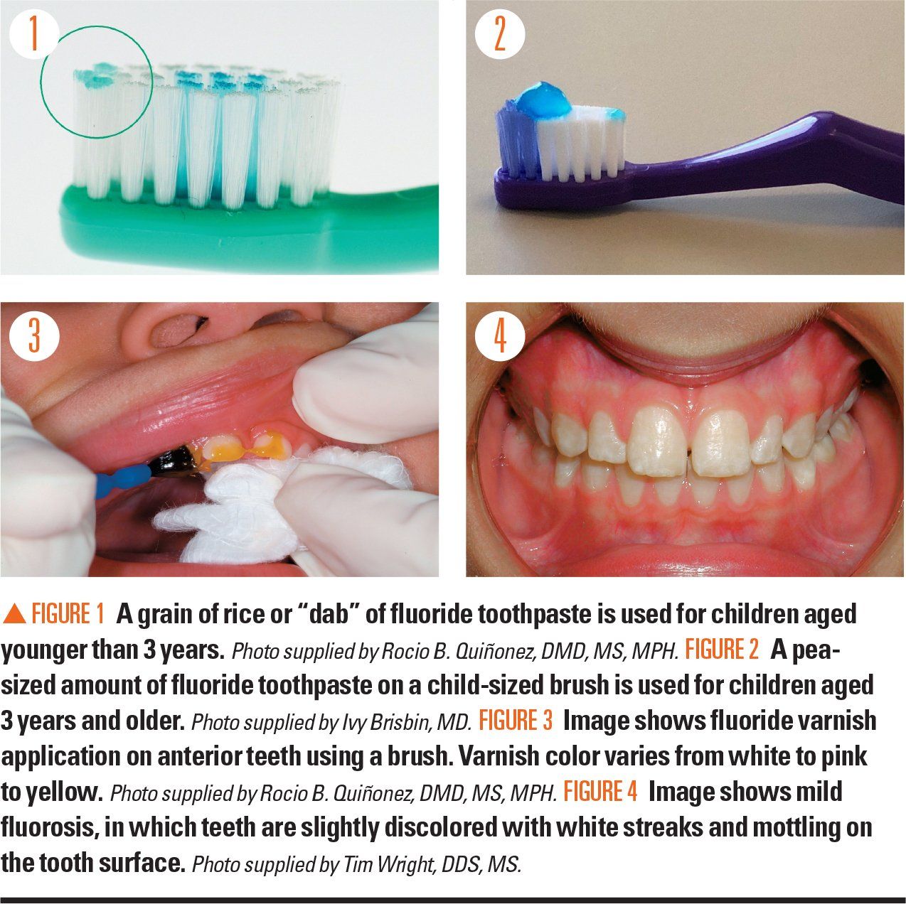 fluoride toothpaste application technique
