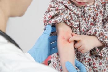 Chronic skin disorders linked to psychological distress and poorer quality of life in children | Image credit: © triocean - stock.adobe.com
