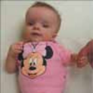 WHAT'S YOUR DIAGNOSIS? Six-month-old girl with dysmorphic appearance referred for genetic evaluation