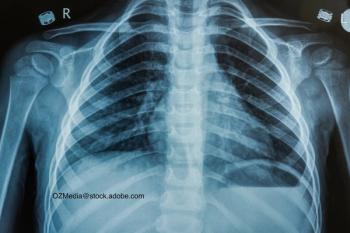 chest x-ray