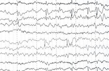 EEG readout